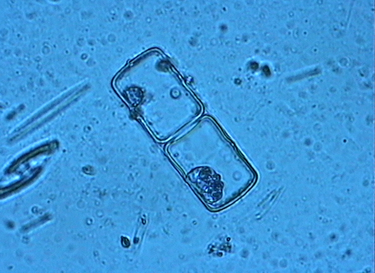 Dictyocha speculum